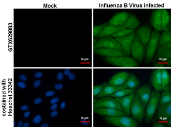 Anti-Influenza B virus Nucleoprotein antibody [GT382] used in Immunocytochemistry/ Immunofluorescence (ICC/IF). GTX629883